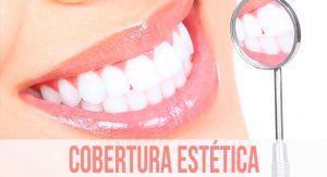 Plano odontológico e cobertura estética